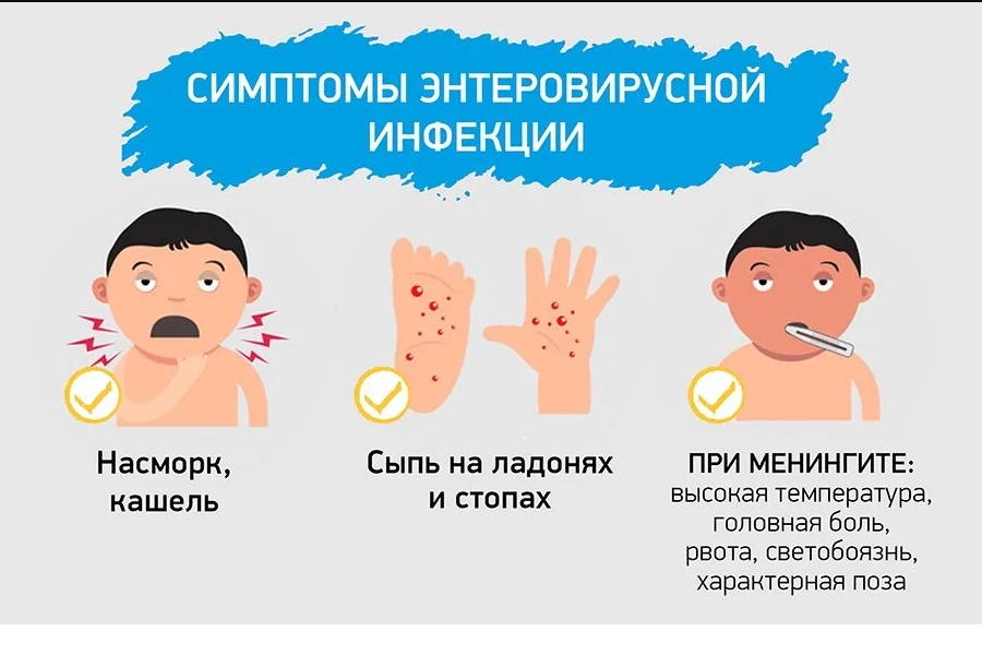 ЭВИ